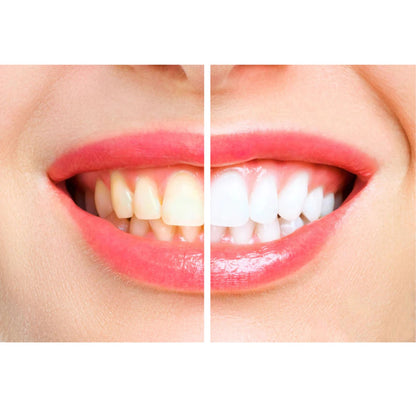 Serenosole™ VibrantSmile | Reinigt deine Zähne wie ein Profi mit kraftvollen Vibrationen | Perfekte Zahnbürste 2025